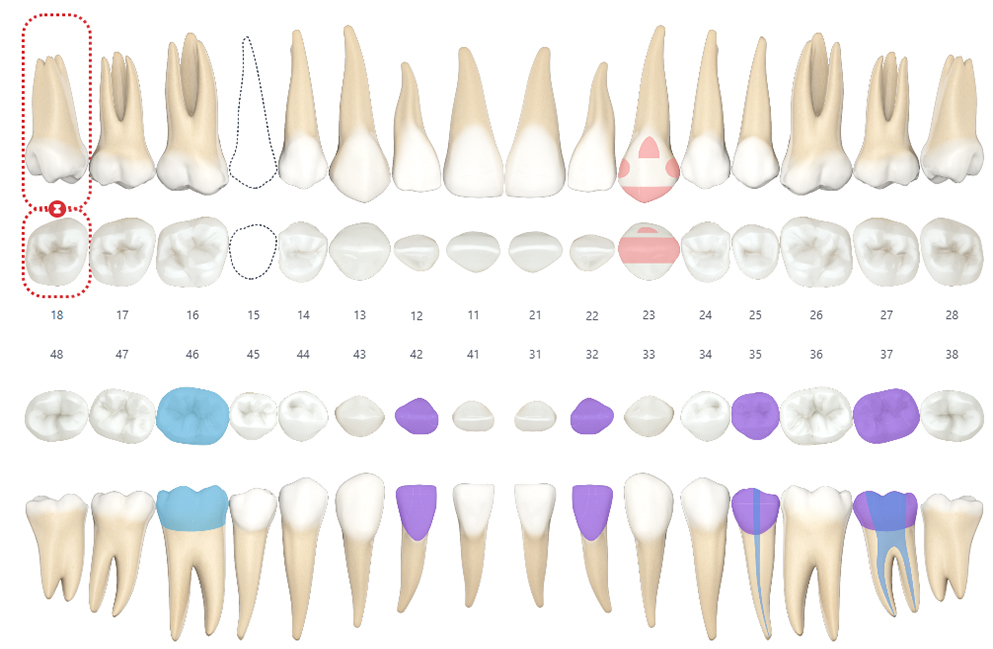 Dental Chart